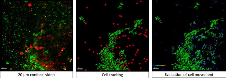 Imaging bridges pathology and radiology