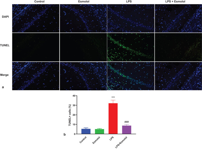 Esmolol inhibits cognitive impairment and neuronal inflammation in mice with sepsis-induced brain injury.