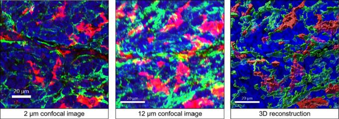 Imaging bridges pathology and radiology