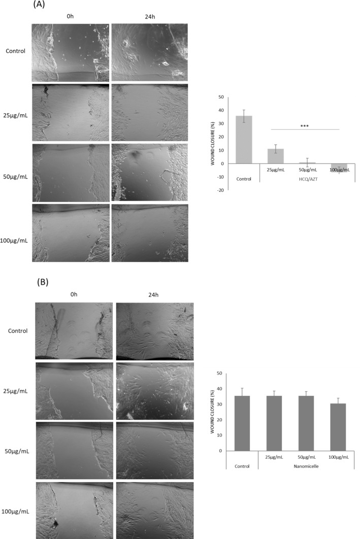 Polymeric nanoparticles and nanomicelles of hydroxychloroquine co-loaded with azithromycin potentiate anti-SARS-CoV-2 effect.