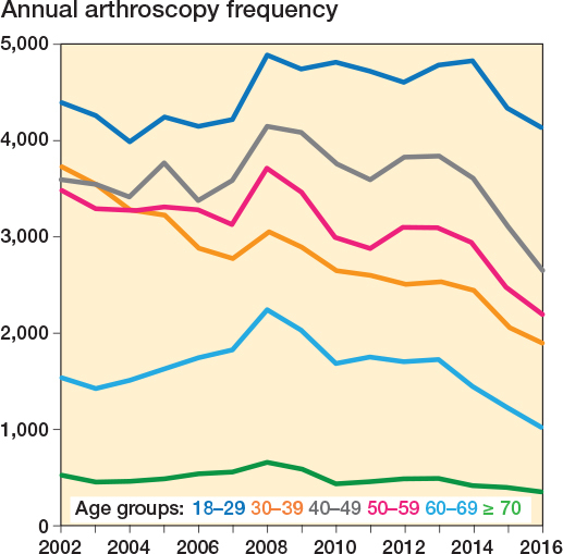 Decreasing incidence of knee arthroscopy in Sweden between 2002 and 2016: a nationwide register-based study.