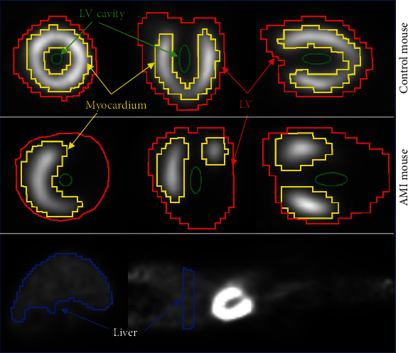 Enhanced Extraction of Blood and Tissue Time-Activity Curves in Cardiac Mouse FDG PET Imaging by Means of Constrained Nonnegative Matrix Factorization.