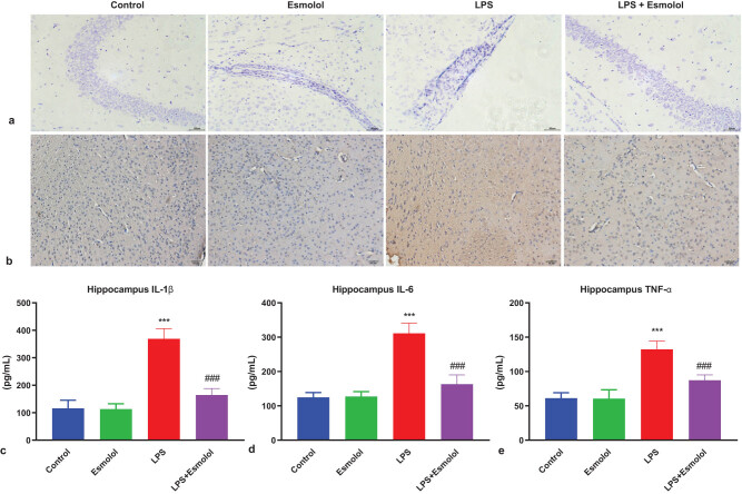 Esmolol inhibits cognitive impairment and neuronal inflammation in mice with sepsis-induced brain injury.