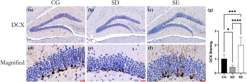 Enriched environment can reverse chronic sleep deprivation-induced damage to cellular plasticity in the dentate gyrus of the hippocampus.