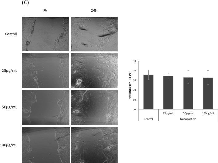 Polymeric nanoparticles and nanomicelles of hydroxychloroquine co-loaded with azithromycin potentiate anti-SARS-CoV-2 effect.