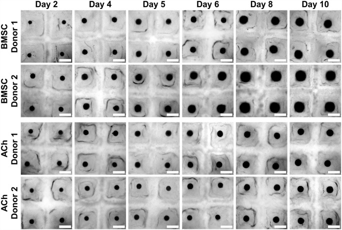 Method for manufacture and cryopreservation of cartilage microtissues.