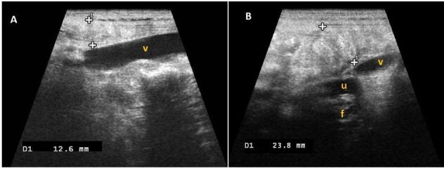 Maternal and fetal ultrasonography, vulvar temperature and vaginal mucous impedance for the prediction of parturition in Saanen does.