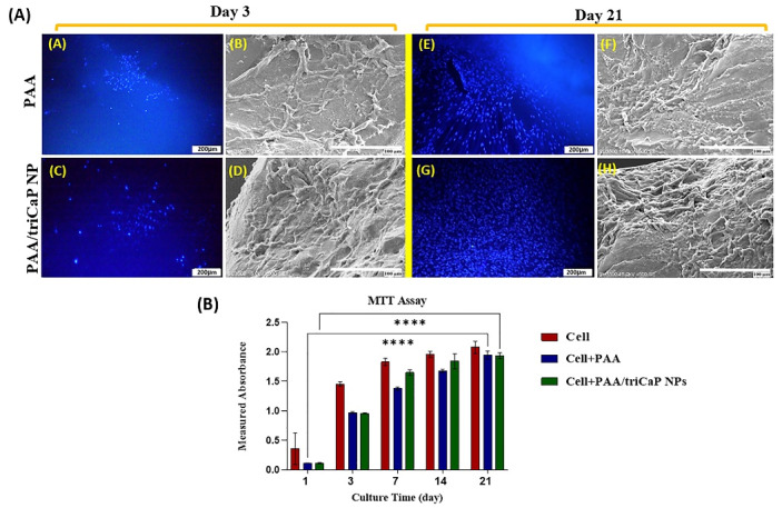 Preparation of poly(acrylic acid)/tricalcium phosphate nanoparticles scaffold: Characterization and releasing UC-MSCs derived exosomes for bone differentiation.