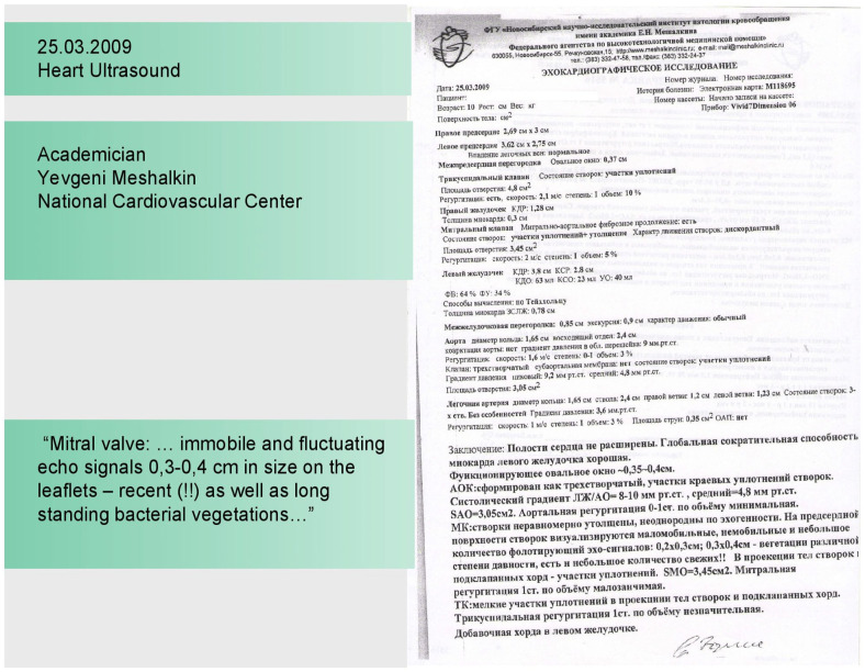 A Case of Infective Endocarditis Treated With Homeopathy Medicine.