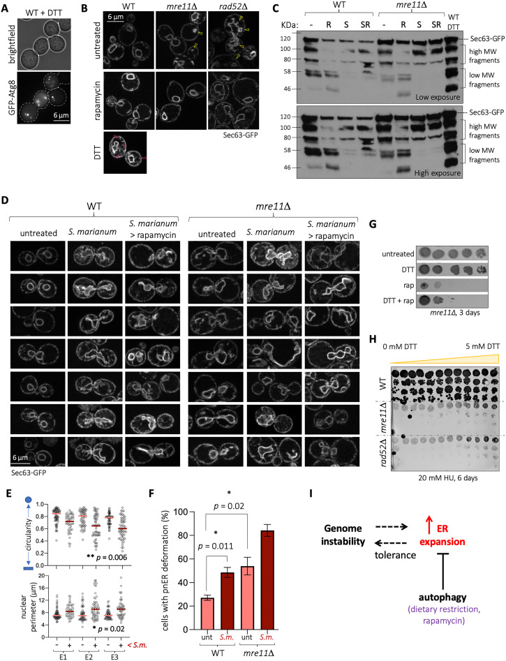 An Expansion of the Endoplasmic Reticulum that Halts Autophagy is Permissive to Genome Instability.