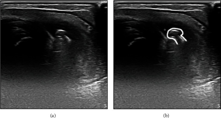 Delayed Urethral Obstruction after Migration of a Ballistic Pellet in an Alpine Wether.