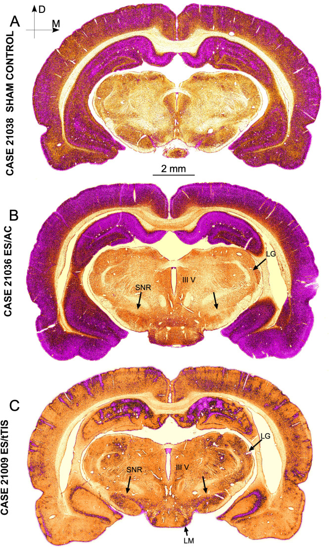 Comparing the effects of transcranial alternating current and temporal interference (tTIS) electric stimulation through whole-brain mapping of c-Fos immunoreactivity.