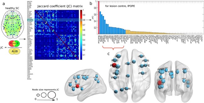 Structural-and-dynamical similarity predicts compensatory brain areas driving the post-lesion functional recovery mechanism.