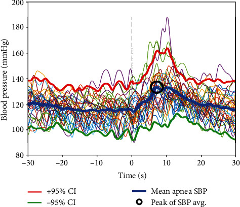 Respiratory Event-Induced Blood Pressure Oscillations Vary by Sleep Stage in Sleep Apnea Patients.