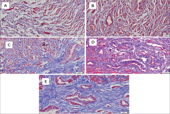 TGF-β1 Effects on Total Collagen of the New Zealand Rabbit's Urethral Wall (Oryctolagus cuniculus) in Animal Models of Urethral Stricture.