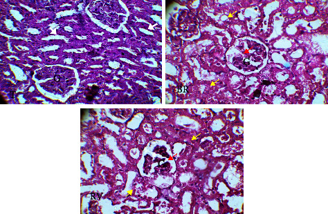 Phytochemical Screening, Antioxidant Activity, and Acute Toxicity Evaluation of <i>Senna italica</i> Extract Used in Traditional Medicine.