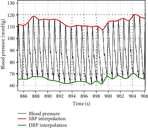 Respiratory Event-Induced Blood Pressure Oscillations Vary by Sleep Stage in Sleep Apnea Patients.