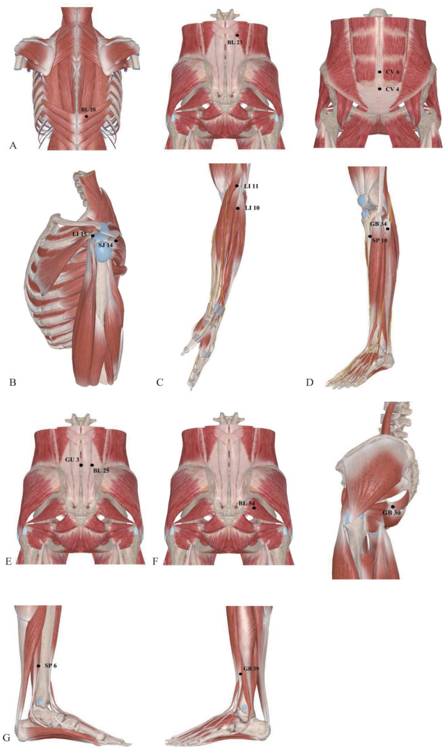 Acupoint Thread Embedding Combined With Wenshen Bugu Decoction for the Treatment of Aromatase Inhibitor-Associated Musculoskeletal Symptom Among Postmenopausal Breast Cancer Patients: Study Protocol of a Randomized Controlled Trial.