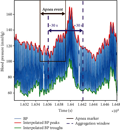 Respiratory Event-Induced Blood Pressure Oscillations Vary by Sleep Stage in Sleep Apnea Patients.