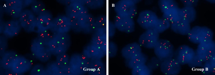 Invasive Breast Cancer with HER2 ≥4.0 and <6.0: Risk Classification and Molecular Typing by a 21-Gene Expression Assay and MammaPrint Plus BluePrint Testing.