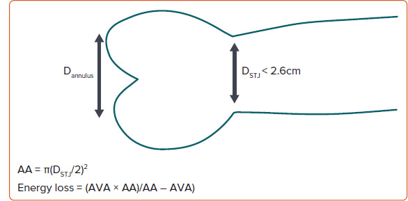 Time to Integrate Sex in Management of Aortic Valve Stenosis.