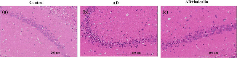 An interventional study of baicalin on neuronal pentraxin-1, neuronal pentraxin-2, and C-reactive protein in Alzheimer's disease rat model.