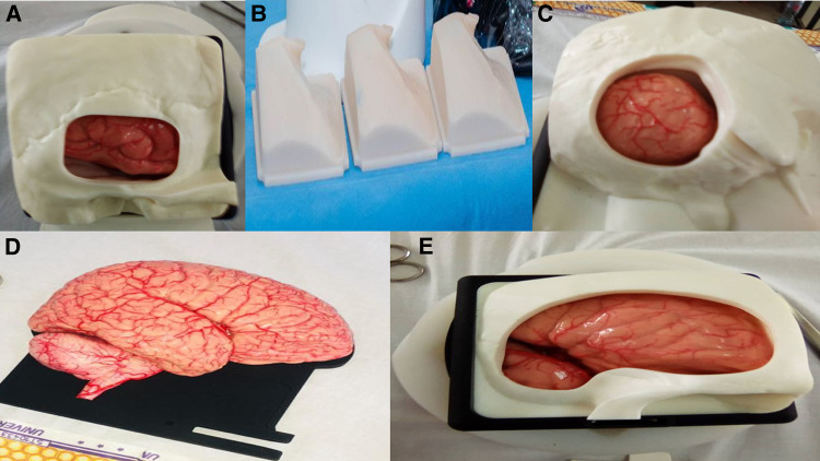 Assessing the impact of neurosurgery and neuroanatomy simulation using 3D non-cadaveric models amongst selected African medical students.