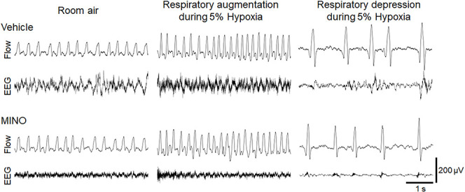 Minocycline prevents hypoxia-induced seizures.