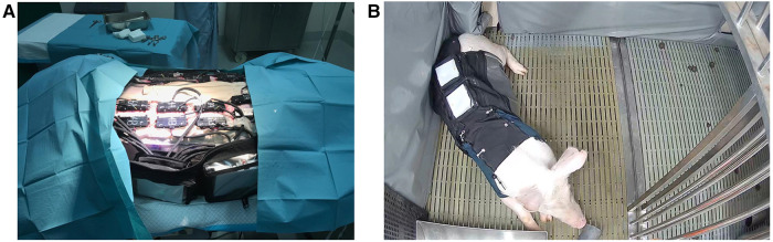 The detection and prediction of surgical site infections using multi-modal sensors and machine learning: Results in an animal model.