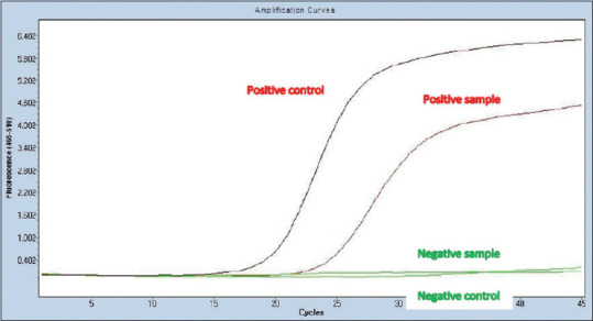 Clinico Virological Characterization of Hand, Foot and Mouth Disease in a Tertiary Care Hospital, South India.