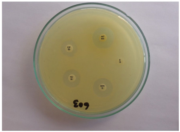 Genotypically Confirmed Vancomycin-Resistant <i>Staphylococcus aureus</i> With <i>vanB</i> Gene Among Clinical Isolates in Kathmandu.