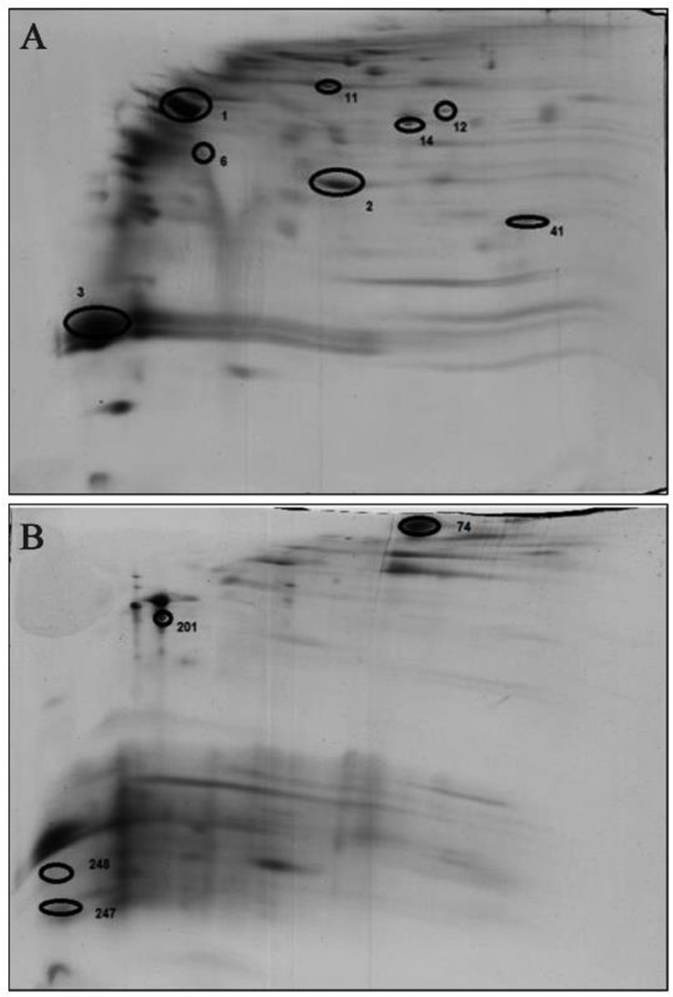 Proteome Analysis of Adult Acute Lymphoblastic Leukemia by Two-dimensional Blue Native/Sodium Dodecyl Sulfate Gel Electrophoresis.