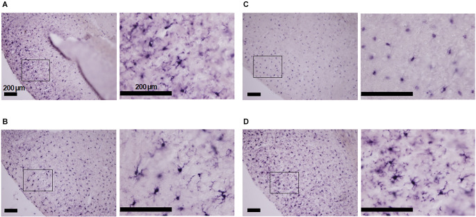 Minocycline prevents hypoxia-induced seizures.