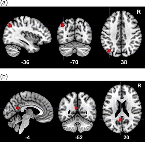 Nonlinear brain correlates of trait self-boundarylessness.