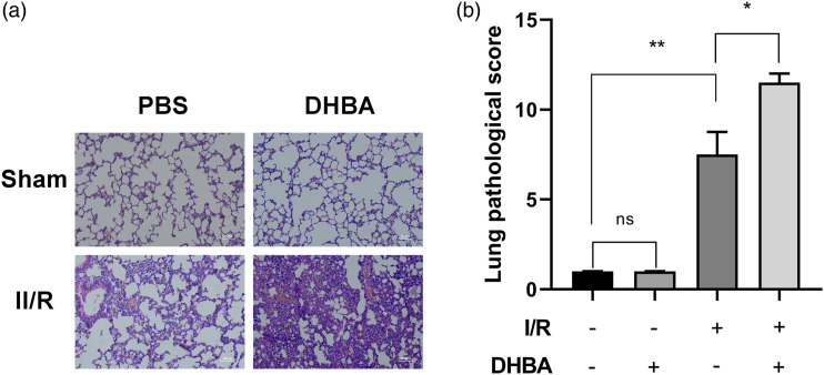 Activation of GPR81 aggravated intestinal ischemia/reperfusion injury-induced acute lung injury via HMGB1-mediated neutrophil extracellular traps formation.