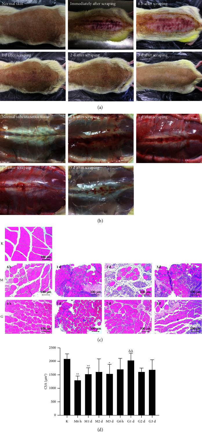 Scraping Therapy Improved Muscle Regeneration through Regulating GLUT4/Glycolytic and AMPK/mTOR/4EBP1 Pathways in Rats with Lumbar Multifidus Injury.