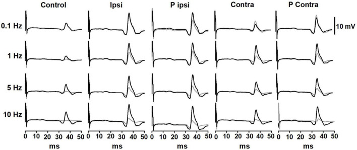 Post-activation depression of the Hoffman reflex is not altered by galvanic vestibular stimulation in healthy subjects.