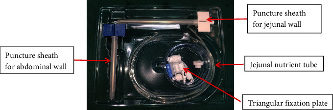 Ultra-Proximal Jejunostomy Application after McKeown-Type Esophagectomy: A Retrospective Case-Series Study.