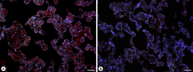 Immunofluorescence Studies on the Expression of the SARS-CoV-2 Receptors in Human Term Placenta.