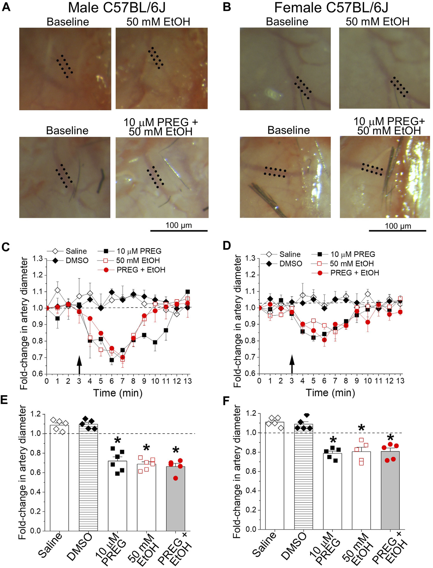 <ArticleTitle xmlns:ns0="http://www.w3.org/1998/Math/MathML">Alcohol and pregnenolone interaction on cerebral arteries through targeting of vascular smooth muscle <ns0:math><ns0:msup><ns0:mrow><ns0:mi>C</ns0:mi><ns0:mi>a</ns0:mi></ns0:mrow><ns0:mrow><ns0:mn>2</ns0:mn><ns0:mo>+</ns0:mo></ns0:mrow></ns0:msup></ns0:math>- and voltage-gated K<sup>+</sup> channels of big conductance.