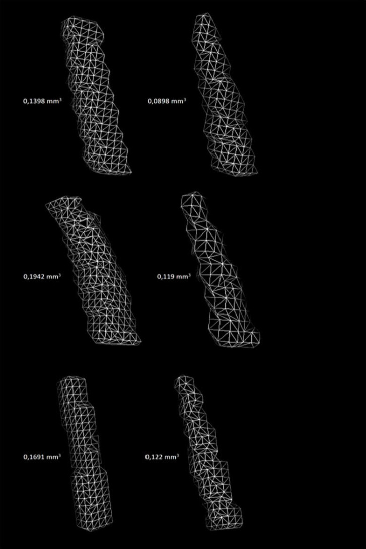 Influence of Apical Patency on the Adaptation of the Master Filling Cone: A Cone-beam Computed Tomography Assessment.