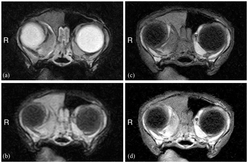 Successful rescue treatment using chlorambucil for presumed recurrence of sinonasal lymphoma in a cat.