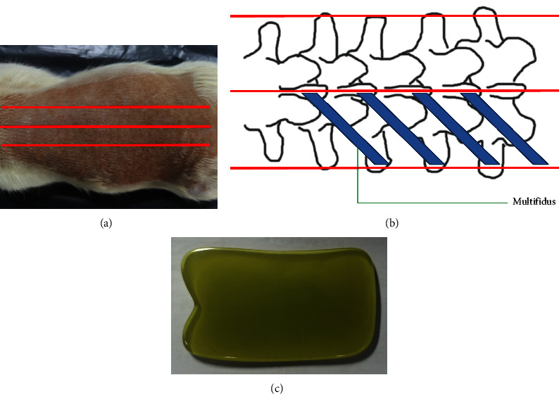 Scraping Therapy Improved Muscle Regeneration through Regulating GLUT4/Glycolytic and AMPK/mTOR/4EBP1 Pathways in Rats with Lumbar Multifidus Injury.