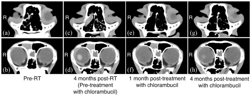 Successful rescue treatment using chlorambucil for presumed recurrence of sinonasal lymphoma in a cat.