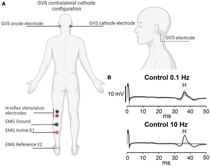 Post-activation depression of the Hoffman reflex is not altered by galvanic vestibular stimulation in healthy subjects.