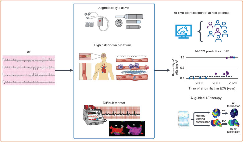 Artificial Intelligence for the Detection and Treatment of Atrial Fibrillation.