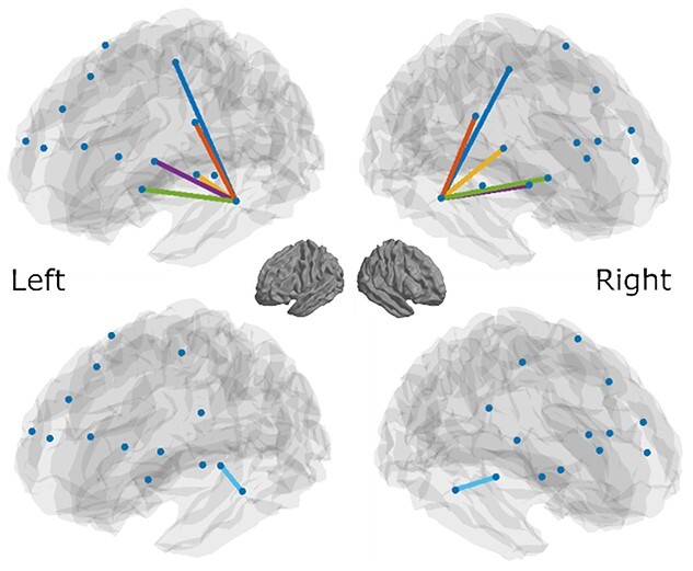 Individual theta-band cortical entrainment to speech in quiet predicts word-in-noise comprehension.