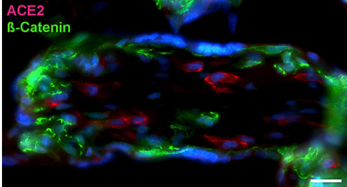 Immunofluorescence Studies on the Expression of the SARS-CoV-2 Receptors in Human Term Placenta.