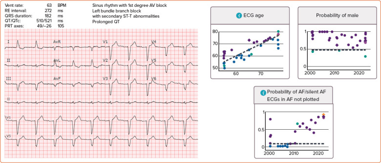 Artificial Intelligence for the Detection and Treatment of Atrial Fibrillation.