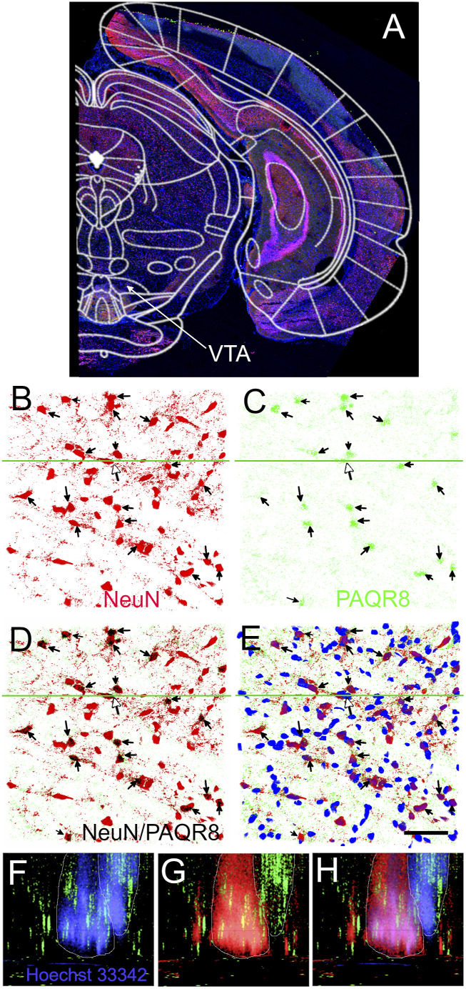 PAQR8 and PAQR9 expression is altered in the ventral tegmental area of aged rats infected with varicella zoster virus.